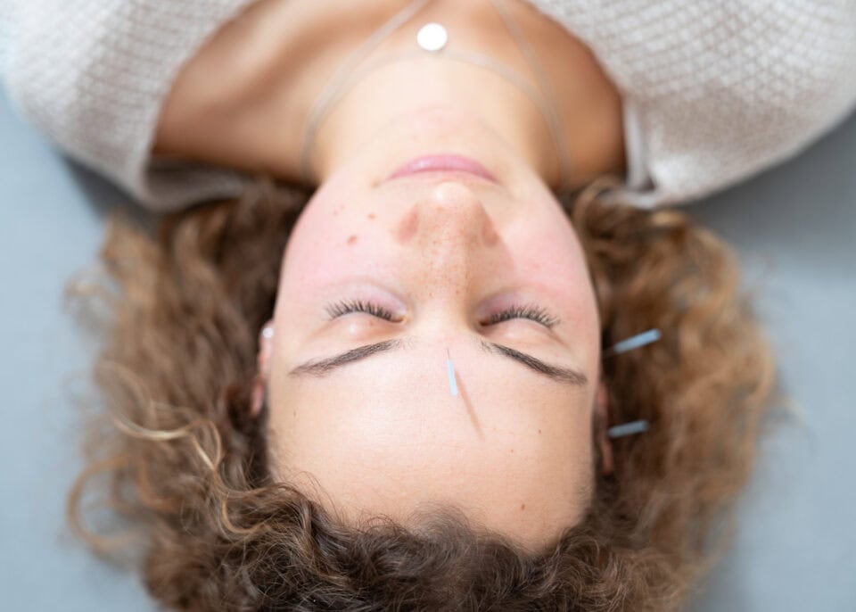 Akupunktur Trofaiach, Ordination Dr. Rubinigg Trofaiach, Akupunktur Gesicht