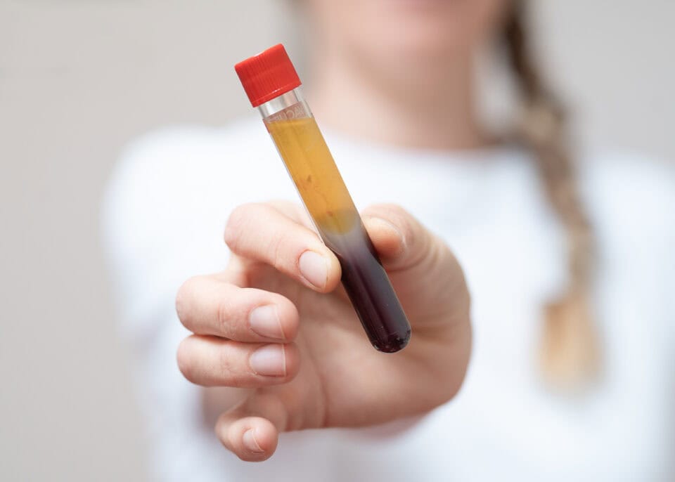 Internistin-Trofaiach-Innere Medizin Trofaiach-Ordination Dr. Rubinigg-zentrifugiertes Blut in Laborröhrchen