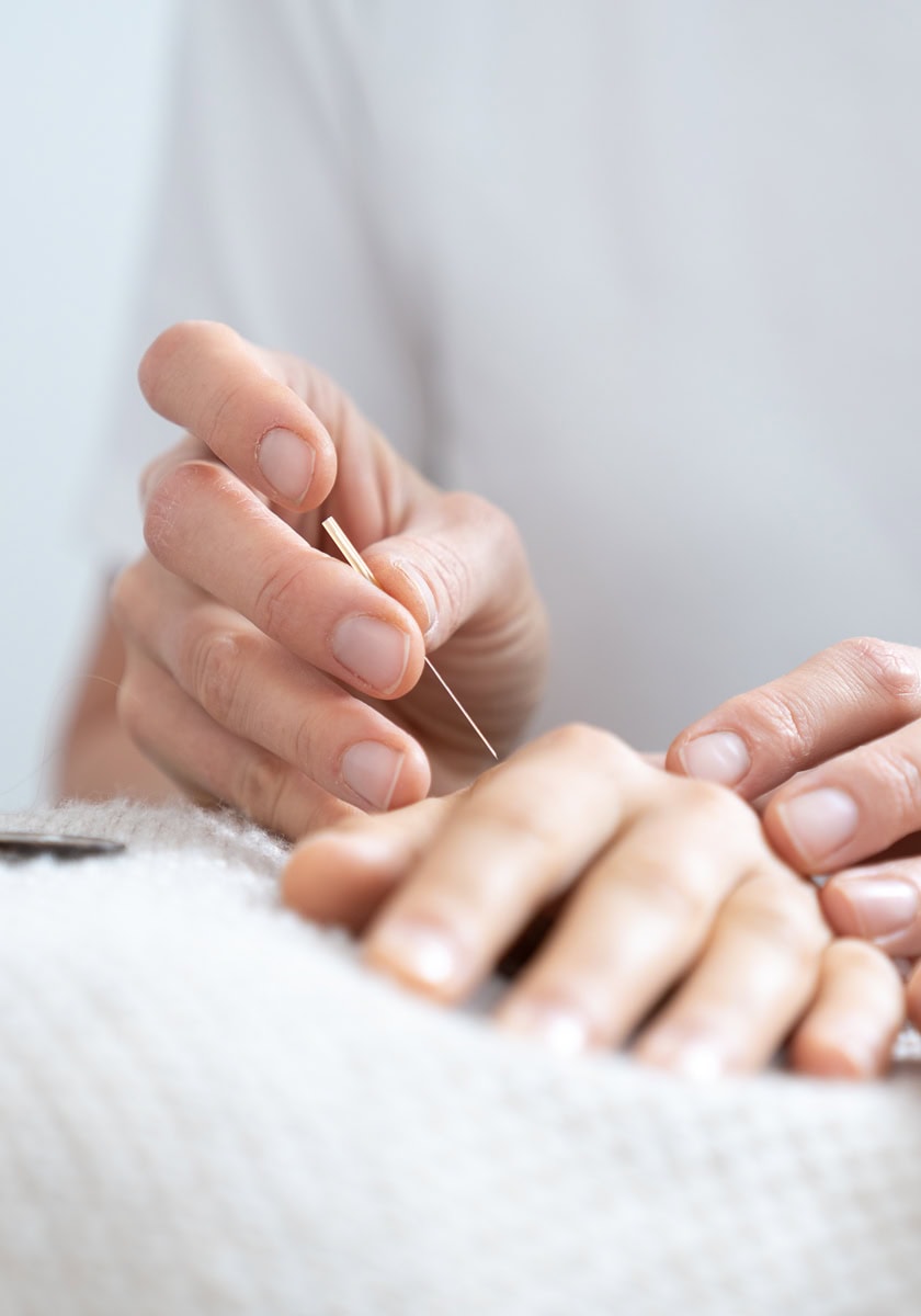 Akupunktur - Ordination Dr. Rubinigg - Trofaiach